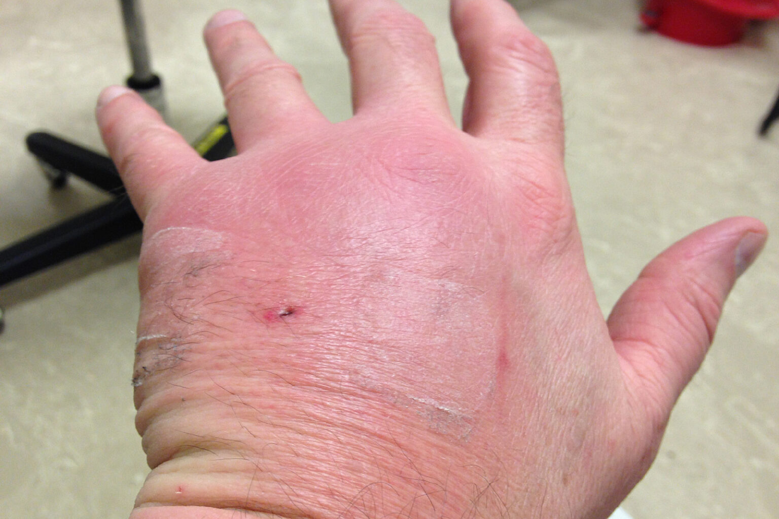 CAN INDOOR CATS GET CAT SCRATCH FEVER? 5 REMEDIES - DorkyCats